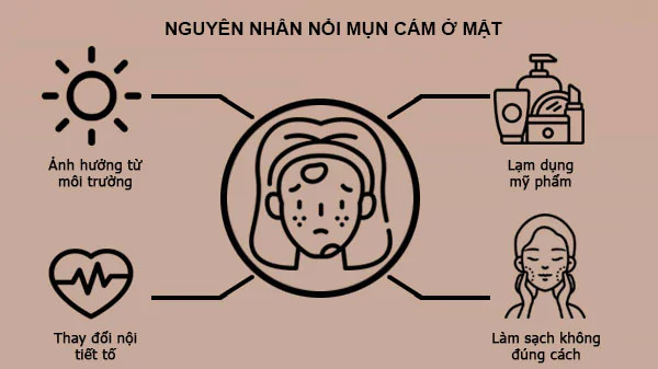 alt: Hình ảnh minh họa các nguyên nhân gây mụn cám