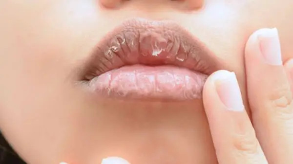alt: Hình ảnh tẩy da chết cho môi bằng mật ong và đường nâu