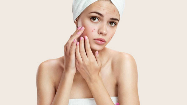 alt text: Hạn chế sờ tay lên mặt để ngăn ngừa mụn