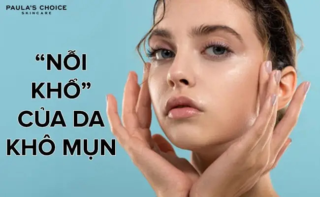 Những “nỗi khổ” của làn da khô mụn