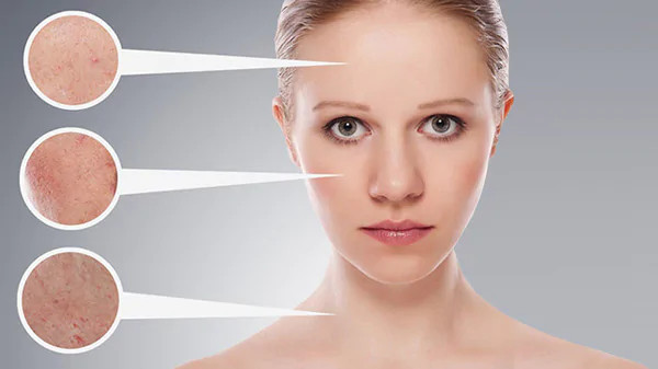 Retinol giúp tái tạo da và thu nhỏ lỗ chân lông