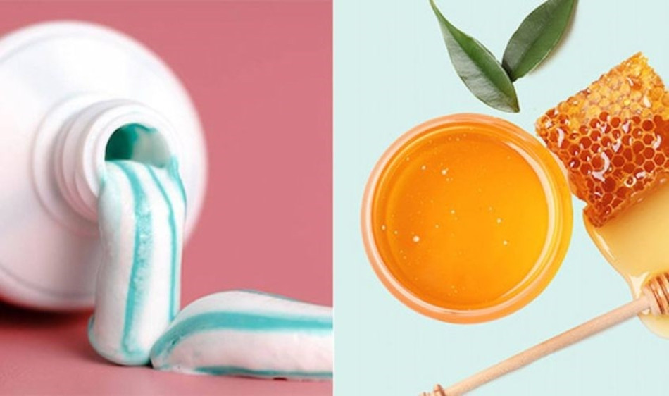 Cách trị nám bằng mật ong và kem đánh răng