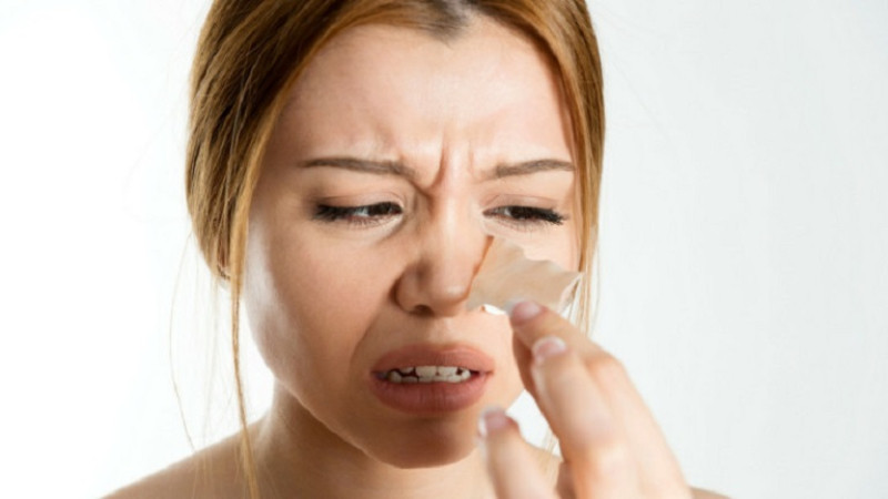 Chăm sóc da sai cách khiến da khô và nổi mụn ẩn
