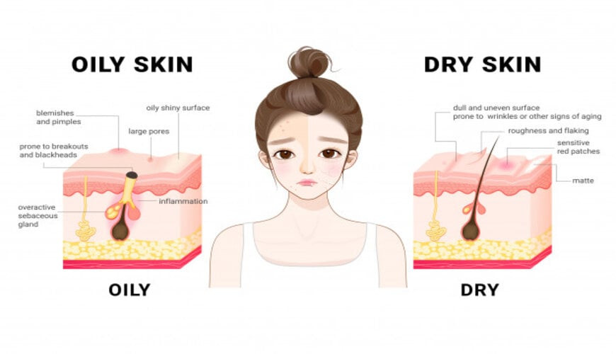 Da dầu là gì? 5 bước chăm sóc da dầu hàng ngày hiệu quả