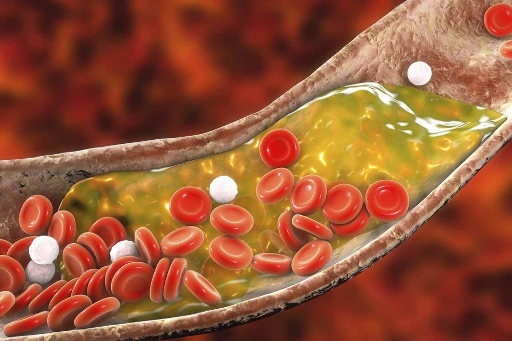 Giảm cholesterol xấu với gạo lứt huyết rồng