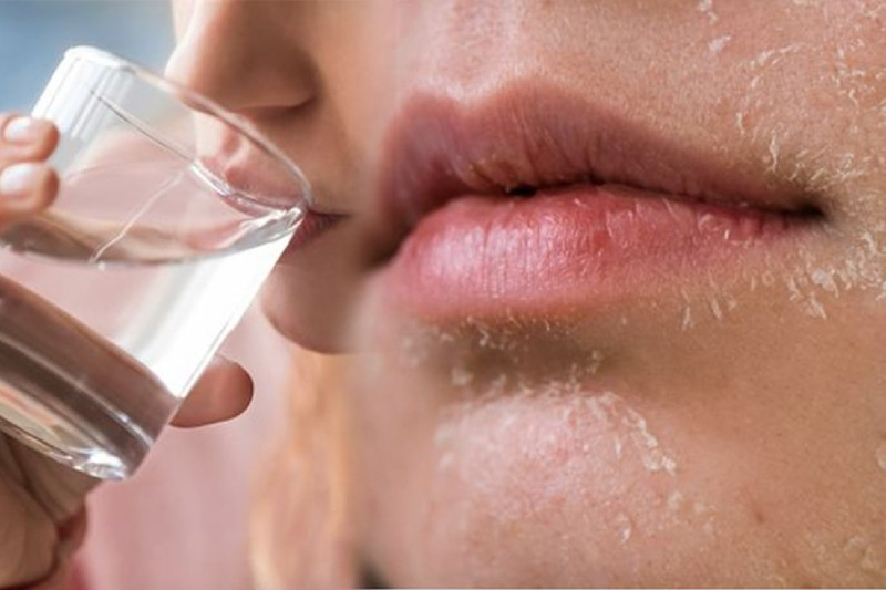 Không cung cấp đủ nước khiến da bị khô và bong tróc