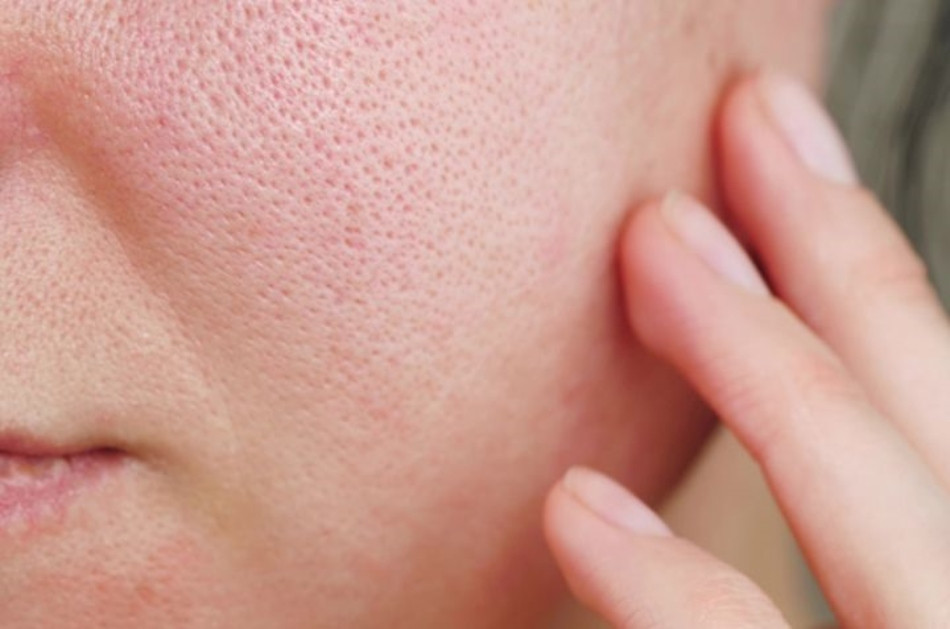 Top 14 mặt nạ giúp se khít lỗ chân lông hiệu quả bất ngờ