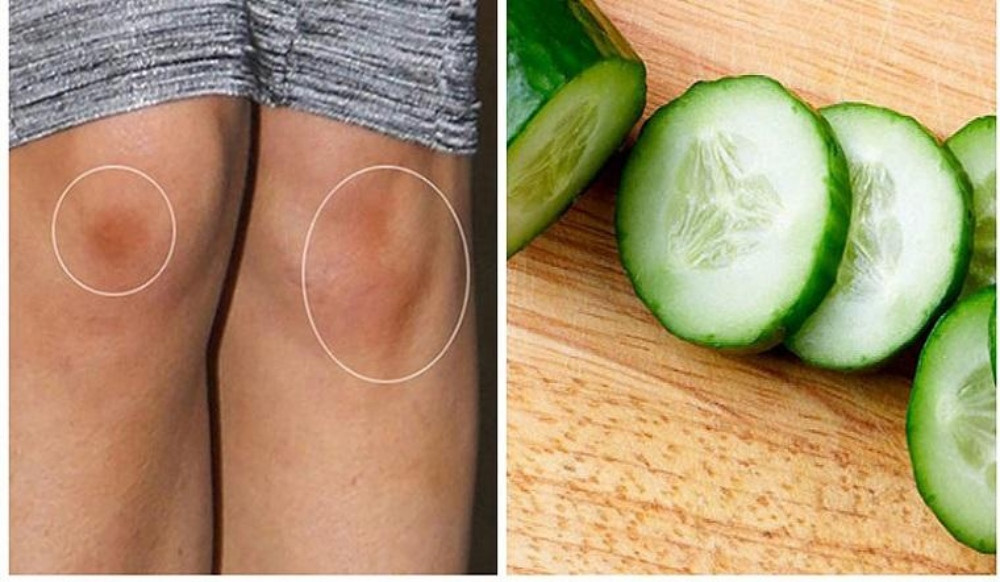 Làm trắng đầu gối, khuỷu tay với dưa chuột