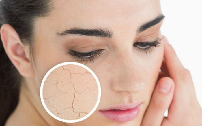 CÁCH CƠ BẢN NHẤT GIÚP PHÂN BIỆT CÁC LOẠI DA.