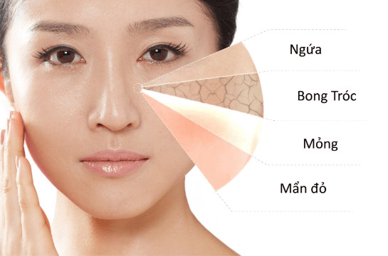 CÁCH CƠ BẢN NHẤT GIÚP PHÂN BIỆT CÁC LOẠI DA.