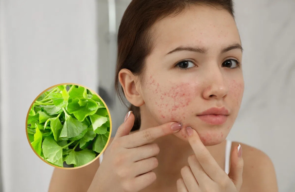Rau má giúp cải thiện tình trạng nhiễm trùng da