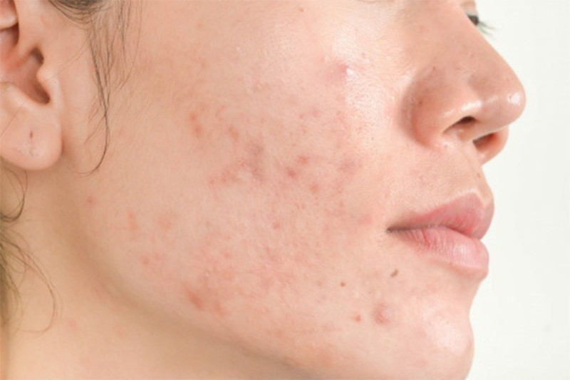 Sản phẩm không phù hợp có thể gây kích ứng cho da