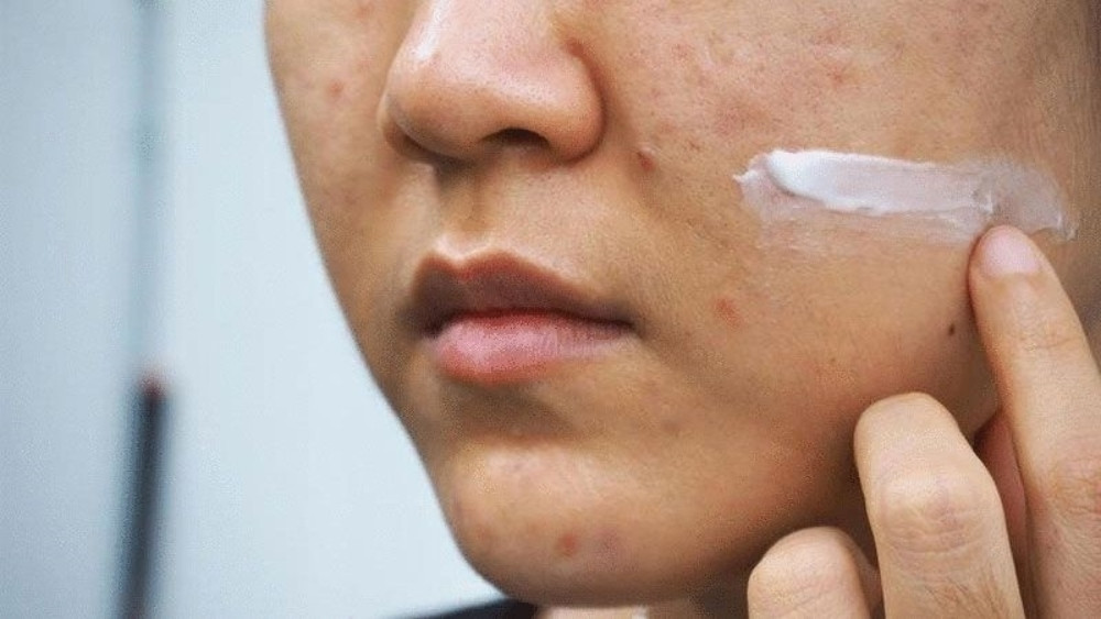Sử dụng các loại thuốc hỗ trợ giúp làm lành vết thương