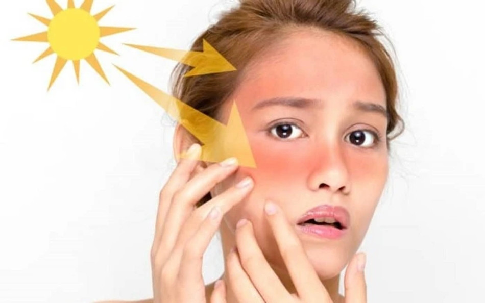 Tiếp xúc với ánh nắng mặt trời gây nám tàn nhang