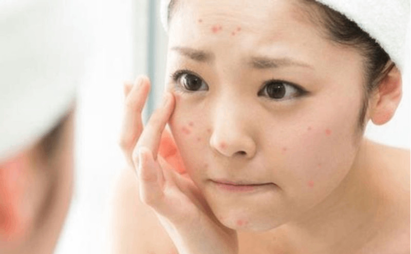 Tình trạng da nhạy cảm có thể thay đổi tùy thuộc vào cơ địa.