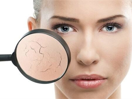 Nguyên nhân khiến kem chống nắng làm khô da