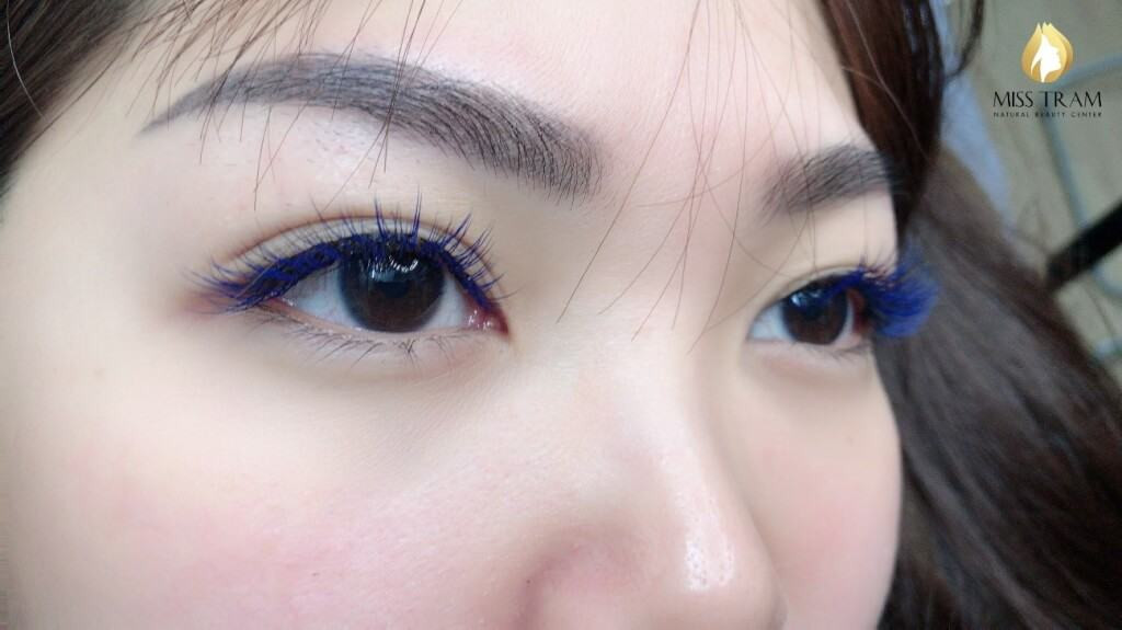 Thời gian duy trì mi nối